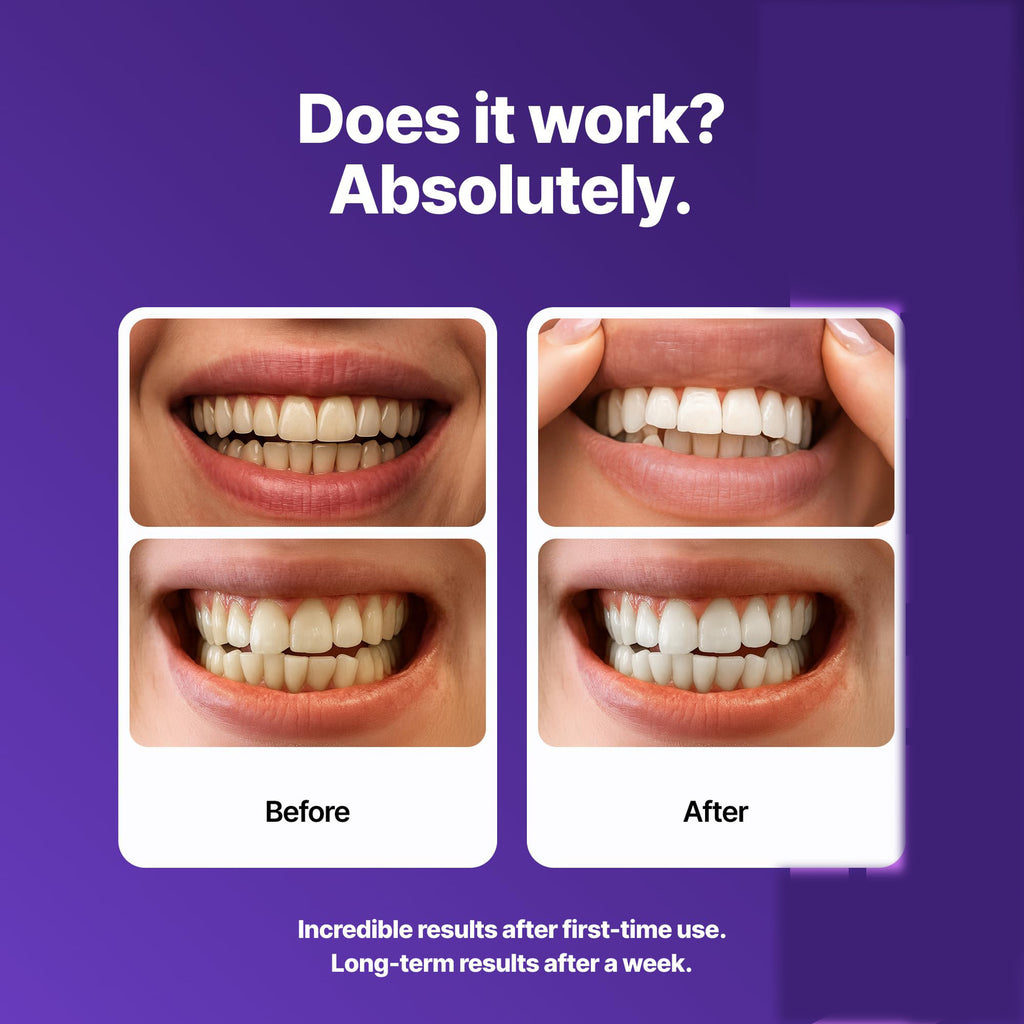 Enamel layer teeth stickers