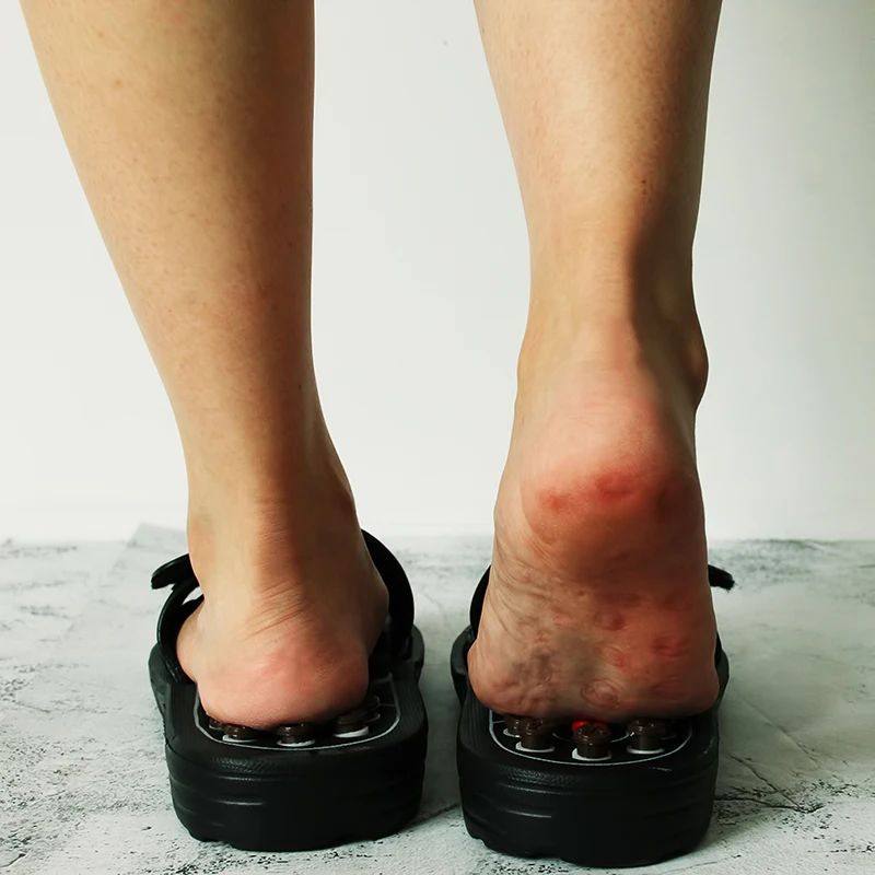 Acupressure Massage Slippers for Foot Relaxation